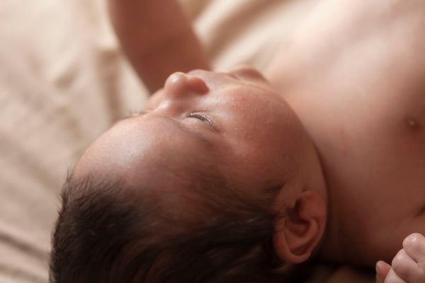 common newborn rashes